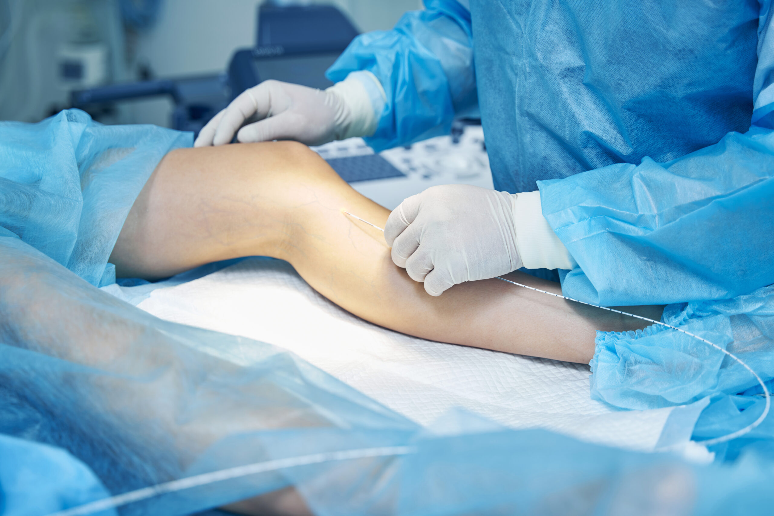 Patellofemoral Reconstruction